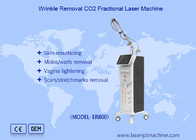Vertical Fractional Co2 Laser Machine Penghapusan Pigmen Penghapusan Luka