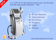 Klinik Peremajaan Kulit Peralatan Kecantikan / Kecantikan Peralatan Laser Penghapusan Tato