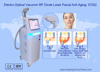Vacuum 915nm Diode 40ms RF Beauty Equipment