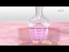 MLS05 Portable 40K Kavitasi Vakum RF Ultrasonik Selulit Mengurangi Perangkat