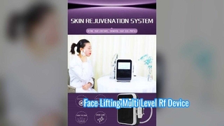 Perawatan Mata 60W Non Invasif Garis Halus Halus Perangkat Frekuensi Radio Multi Level