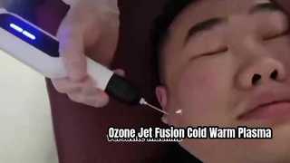 Ozone Jet Fusion Mesin Plasma Dingin Dan Panas Untuk Pengeringan Kulit Penghapusan Kerutan