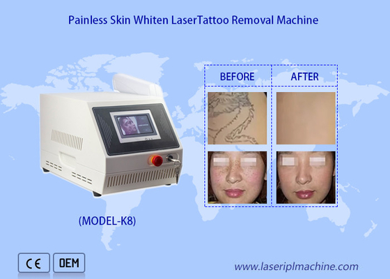 1320nm 1064nm 532nm Mesin Pemutih Kulit Penghilang Tato Laser Nd Yag Portabel