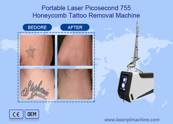 Perangkat Mesin Penghilang Tato Laser Nd Yag Picosecond 755nm 1064nm 532nm