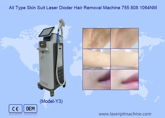 Semua Jenis Kulit Tidak Menyakitkan 1064 755 808nm Diode Laser Hair Removal Machine