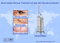 RF Fractional CO2 Laser Untuk Stretch Marks Scar Removal Mesin Penekanan Vaginal