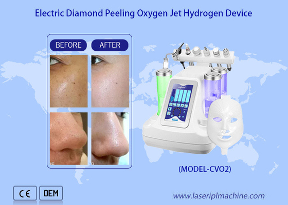Ringan Wajah Air Oxygen Jet Peel Machine / Hydro Dermabrasion Air Oxygen Jet deep skin cleaning