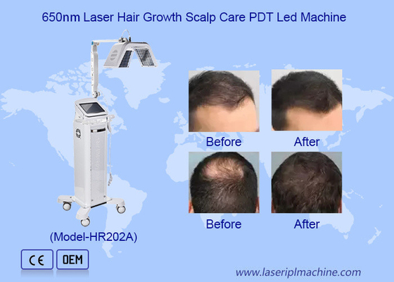 Aman Frekuensi Tinggi Mesin Stimulator Pertumbuhan Rambut Mesin Laser Therapy