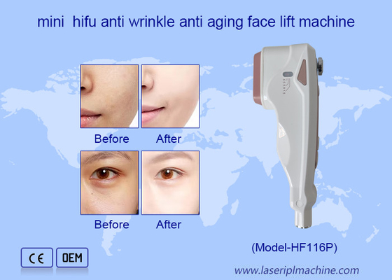 Penggunaan Rumah HIFU Perawatan Wajah Penghapusan Kerutan Peremajaan Kulit Mesin face lifting