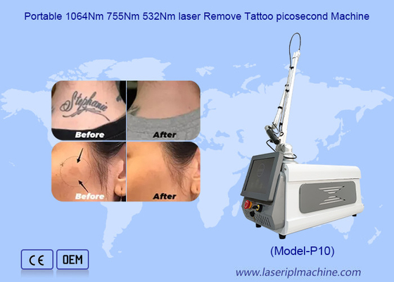Pemutih Kulit Portable Picosecond Penghapusan Tato Nd Yag Laser Machine
