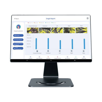 Harga yang bagus 4 Bahasa Cerdas AI Analisis Kulit Kepala Perawatan Kulit Kepala Mesin Kepala yang Ditargetkan on line