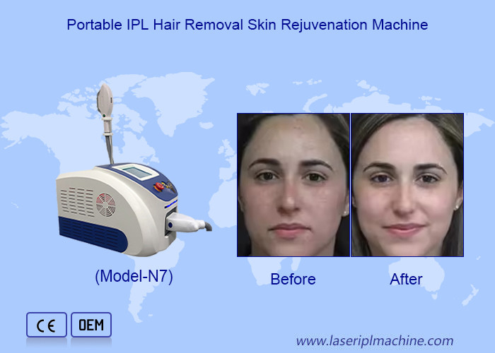 Advanced IPL Laser Hair Removal dan Peremajaan Kulit Dengan Crystal Cahaya Safir Impor
