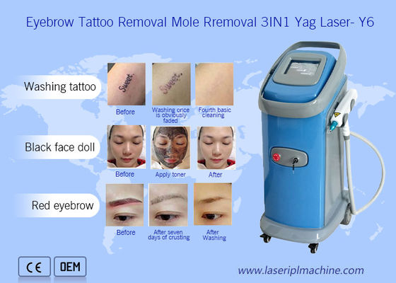 Harga yang bagus 1064nm 532nm Nd Yag Laser Mesin Penghapusan Tato Dermatologi on line