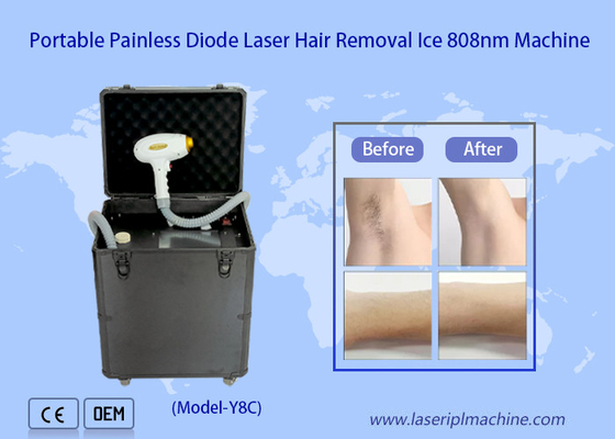 Mesin Laser Pulse Diode 808nm yang Dapat Disesuaikan Untuk Menghilangkan Rambut