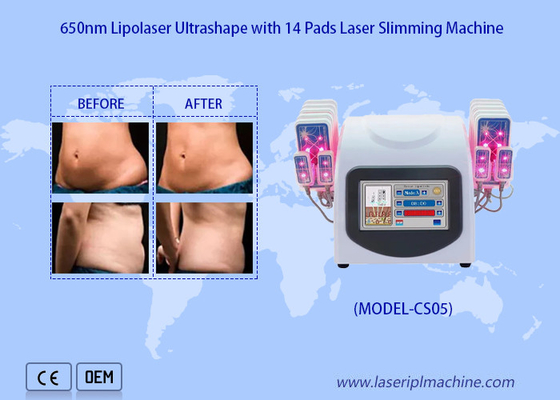 650nm Lipo Laser Pads Mesin Sedot Lemak Laser Untuk Mengurangi Penghapusan Lemak Selulit