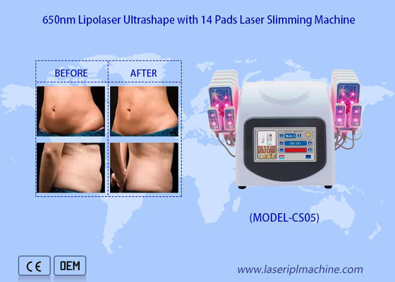 Harga yang bagus 650nm Lipo Laser Pads Mesin Sedot Lemak Laser Untuk Mengurangi Penghapusan Lemak Selulit on line