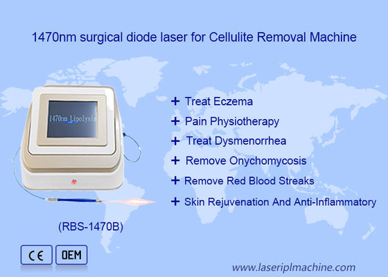 Harga yang bagus 1470nm 980nm Diode Laser Lipolysis Bedah Perangkat Laser Larut lemak on line