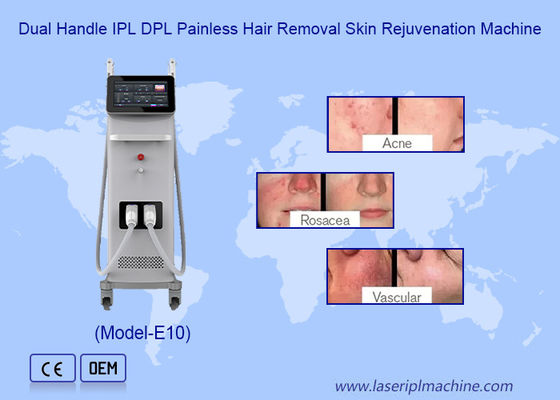 Harga yang bagus Profesional Permanen IPL OPT Epilator Mesin Pengeringan Kulit Penghapusan Rambut on line