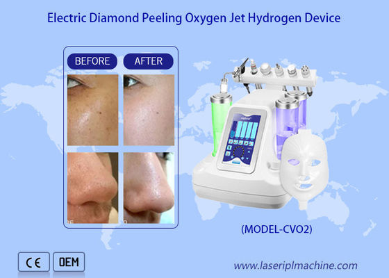 Harga yang bagus Ringan Wajah Air Oxygen Jet Peel Machine / Hydro Dermabrasion Air Oxygen Jet deep skin cleaning on line
