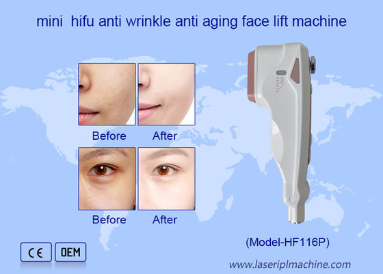 Harga yang bagus Penggunaan Rumah HIFU Perawatan Wajah Penghapusan Kerutan Peremajaan Kulit Mesin face lifting on line